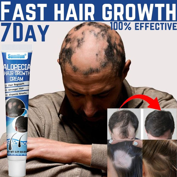 Sumifun Hair Growth Cream 20g – Scalp Care
