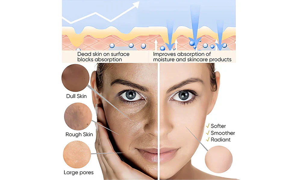 Orange Brightening Gel removes dead skin