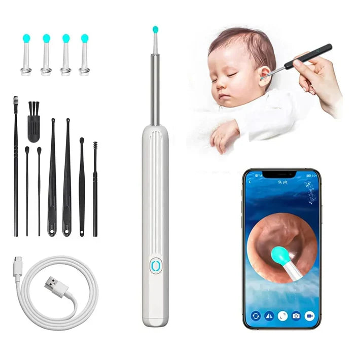 1080P HD Smart Earwax Removal Kit – Camera Cleaner