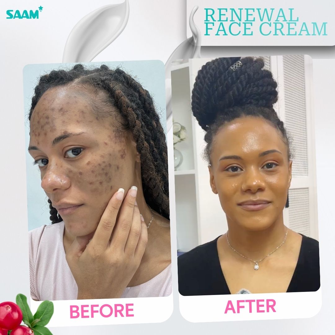 Daily Moisturizing & Skin Repair Cream SAAM