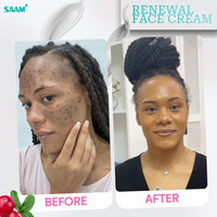 SAAM Renewal Face Cream – Daily Moisturizer