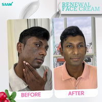 SAAM Renewal Face Cream – Daily Moisturizer