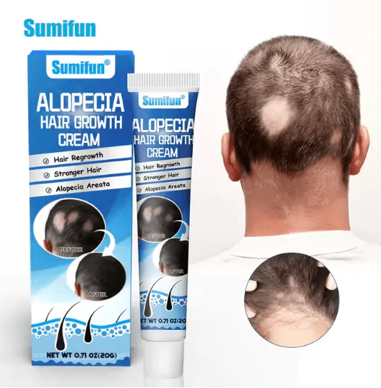 Sumifun Herbal Scalp Strengthening Cream – Hair Care
