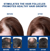 Sumifun Herbal Scalp Strengthening Cream – Hair Care