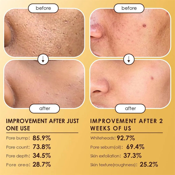 Dr Melaxin Peel Shot P5 Exfoliating Ampoule